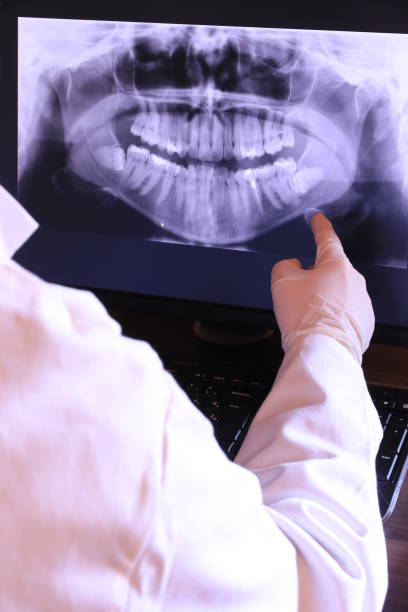 Best Emergency Dental Care for Broken or Chipped Teeth in Security Widefield, CO