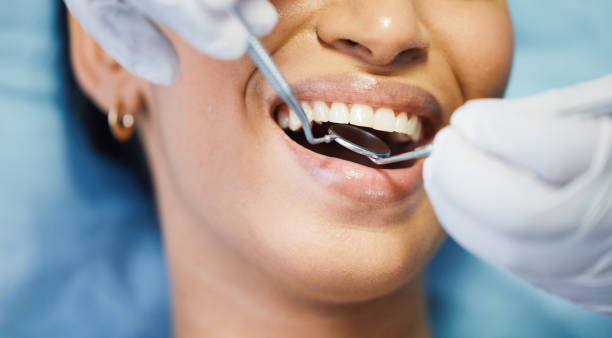 Best Urgent Care for Lost Fillings or Crowns in Security Widefield, CO