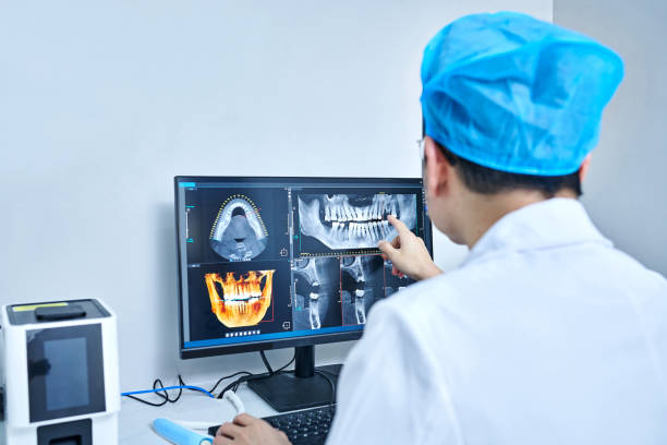 Best Emergency Wisdom Teeth Removal in Security Widefield, CO