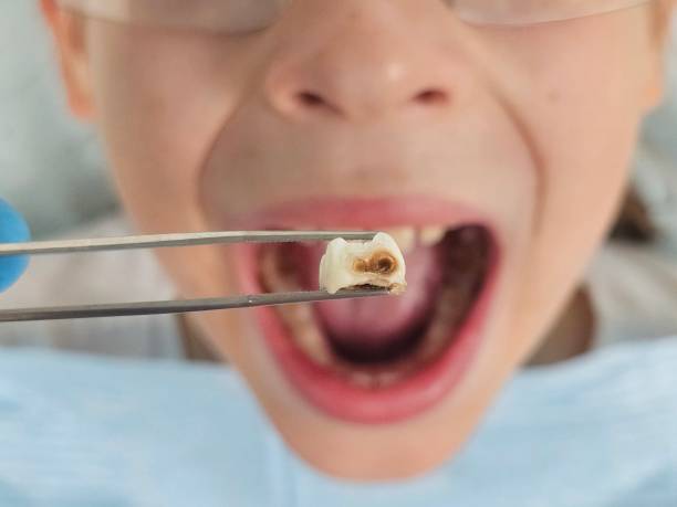 Best Emergency Denture Repair in Security Widefield, CO
